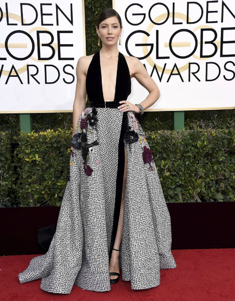 Golden Globes 2017
